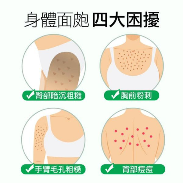 Body Face Peeling Kit – Body Acne Spray & Peeling Cream/ 2pcs, 